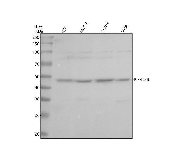 Western blot analysis of PIP4K2C using anti-PIP4K2C antibody (A10431-1)