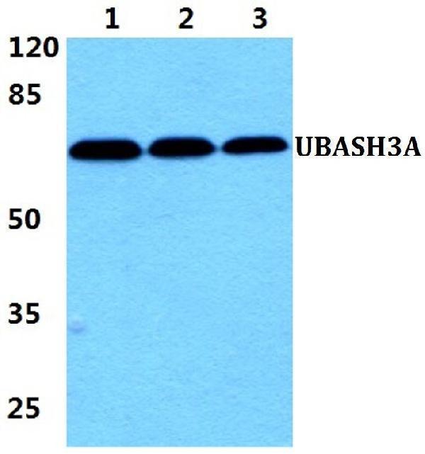Western blot (WB) analysis of UBASH3A polyclonal antibody at 1:500 dilution
Lane1:HEK293T cell lysate
Lane2:sp2/0 cell lysate
Lane3:H9C2 cell lysate
