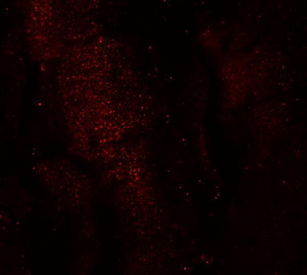 Immunofluorescence of RKHD3 in mouse skeletal muscle cells with RKHD3 antibody at 20 μg/mL