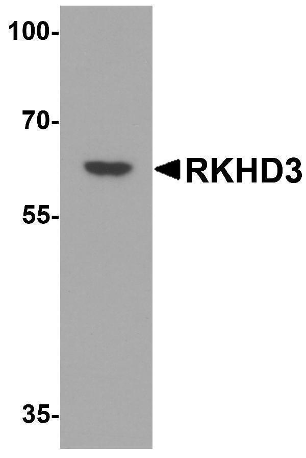 Western blot analysis of RKHD3 in human testis tissue lysate with RKHD3 antibody at 1 μg/mL