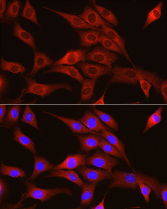Immunofluorescence analysis of NIH/3T3 cells using TRIM4 Rabbit pAb  at dilution of 1:250 