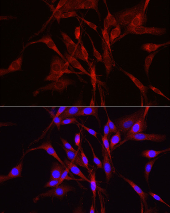 Immunofluorescence analysis of PC-12 cells using TRIM4 Rabbit pAb  at dilution of 1:250 