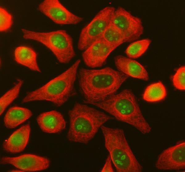 a10439 1 ddx27 primary antibodies if testing 1