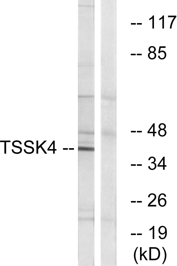 a10441 1 tssk4 primary antibodies wb testing 3