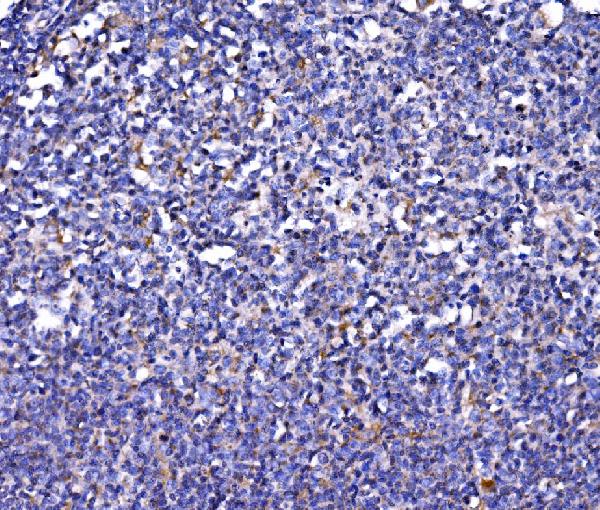 Figure 3. IHC analysis of FKBP135/FKBP15 using anti-FKBP135/FKBP15 antibody (A10447-1). FKBP135/FKBP15 was detected in a paraffin-embedded section of human tonsil tissue. Heat mediated antigen retrieval was performed in EDTA buffer (pH 8.0, epitope retrieval solution). The tissue section was blocked with 10% goat serum. The tissue section was then incubated with 2 microg/ml rabbit anti-FKBP135/FKBP15 Antibody (A10447-1) overnight at 4°C. Biotinylated goat anti-rabbit IgG was used as secondary antibody and incubated for 30 minutes at 37°C. The tissue section was developed using Strepavidin-Biotin-Complex (SABC) (Catalog # SA1022) with DAB as the chromogen.