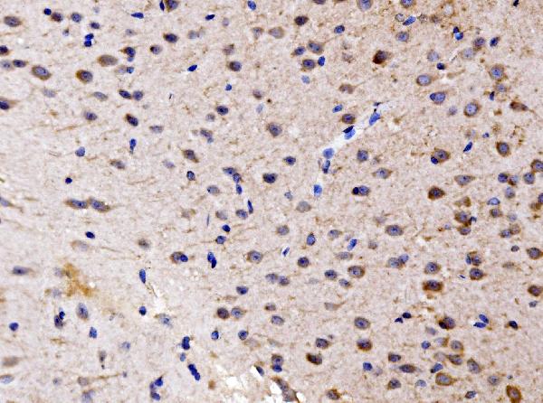Figure 4. IHC analysis of FKBP135/FKBP15 using anti-FKBP135/FKBP15 antibody (A10447-1). FKBP135/FKBP15 was detected in a paraffin-embedded section of mouse brain tissue. Heat mediated antigen retrieval was performed in EDTA buffer (pH 8.0, epitope retrieval solution). The tissue section was blocked with 10% goat serum. The tissue section was then incubated with 2 microg/ml rabbit anti-FKBP135/FKBP15 Antibody (A10447-1) overnight at 4°C. Biotinylated goat anti-rabbit IgG was used as secondary antibody and incubated for 30 minutes at 37°C. The tissue section was developed using Strepavidin-Biotin-Complex (SABC) (Catalog # SA1022) with DAB as the chromogen.
