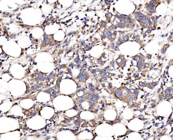 Figure 6. IHC analysis of FKBP135/FKBP15 using anti-FKBP135/FKBP15 antibody (A10447-1). FKBP135/FKBP15 was detected in a paraffin-embedded section of human breast tissue. Heat mediated antigen retrieval was performed in EDTA buffer (pH 8.0, epitope retrieval solution). The tissue section was blocked with 10% goat serum. The tissue section was then incubated with 2 microg/ml rabbit anti-FKBP135/FKBP15 Antibody (A10447-1) overnight at 4°C. Biotinylated goat anti-rabbit IgG was used as secondary antibody and incubated for 30 minutes at 37°C. The tissue section was developed using Strepavidin-Biotin-Complex (SABC) (Catalog # SA1022) with DAB as the chromogen.