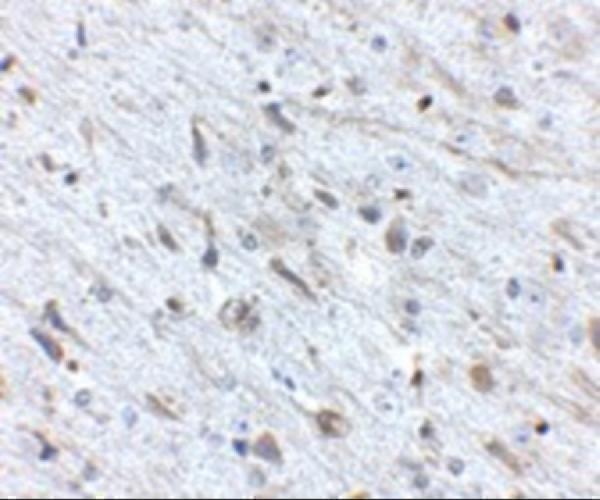 a10447 fkbp15 primary antibodies ihc testing 2