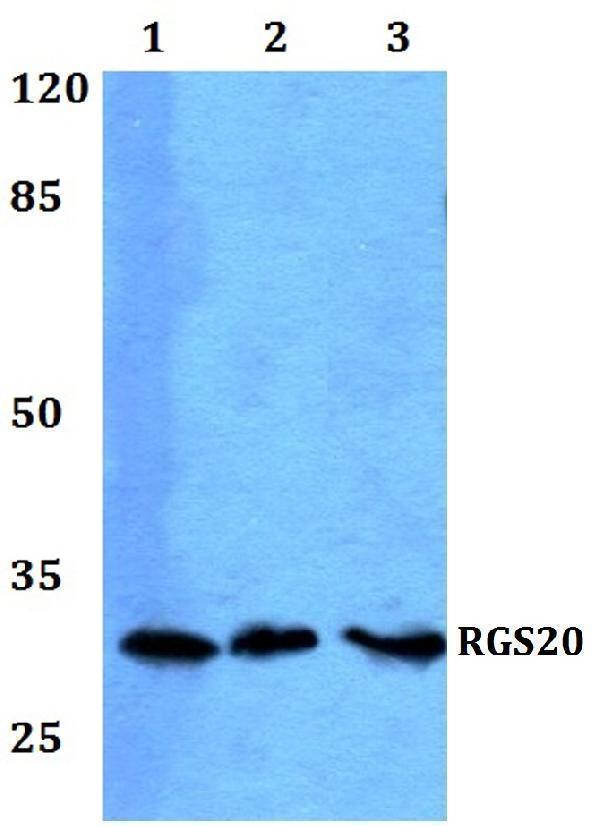 Western blot (WB) analysis of RGS20 polyclonal antibody at 1:500 dilution
Lane1:HEK293T whole cell lysate
Lane2:NIH-3T3 whole cell lysate
Lane3:H9C2 whole cell lysate