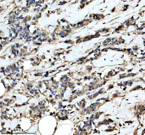 a10450 2 gtpbp4 primary antibodies ihc testing 1