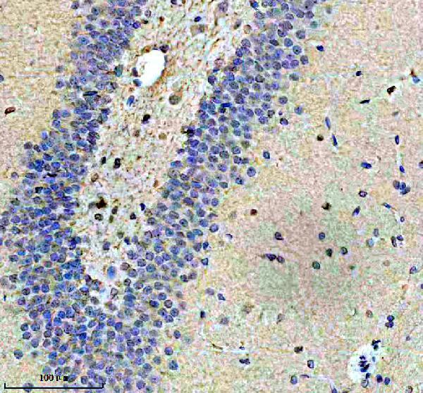 a10450 2 gtpbp4 primary antibodies ihc testing 3