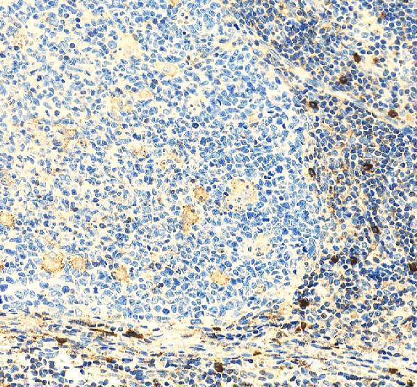 IHC analysis of RAB37 using anti-RAB37 antibody (A10452-1)