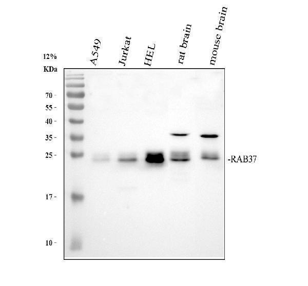  Western blot analysis of RAB37 using anti-RAB37 antibody (A10452-1)