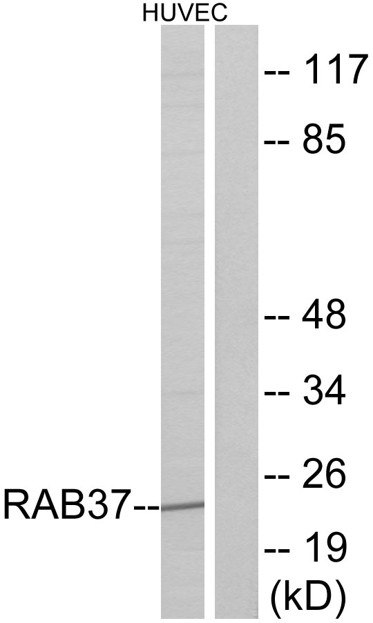 Western blot analysis of lysates from HUVEC cells, using RAB37 Antibody