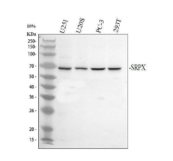 Western blot analysis of SRPX using anti-SRPX antibody (A10454-1)