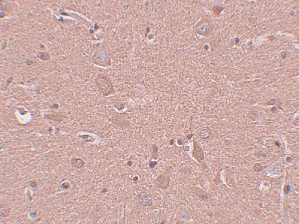 a10454 srpx primary antibodies ihc testing 2