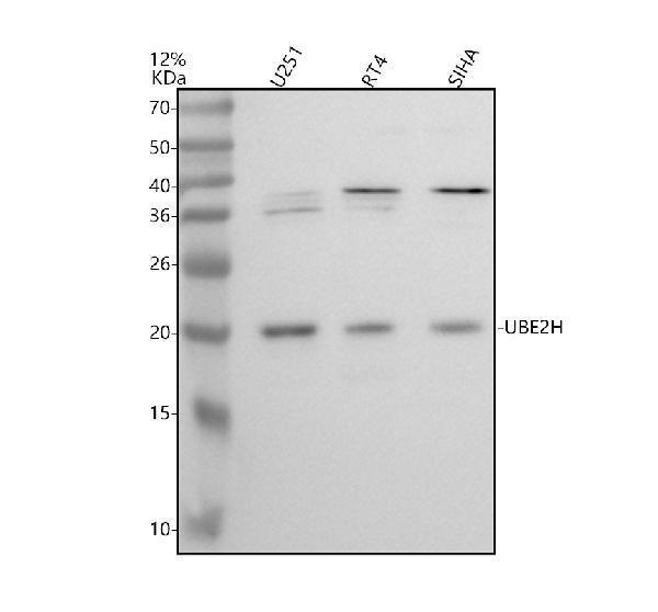 a10471 1 ube2h primary antibodies wb testing 1