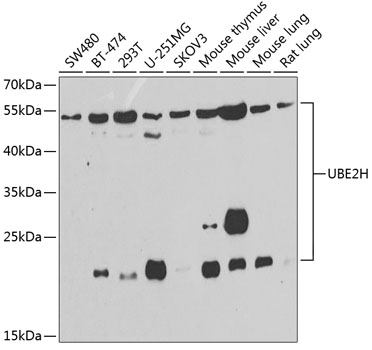 a10471 ube2h primary antiboties wb testing 1