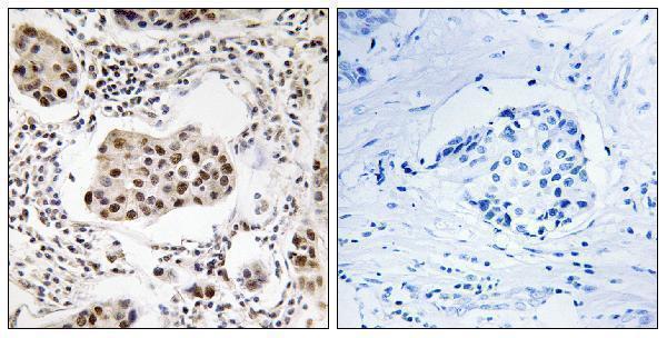 a10474 ppp1r11 primary antibodies ihc testing 1
