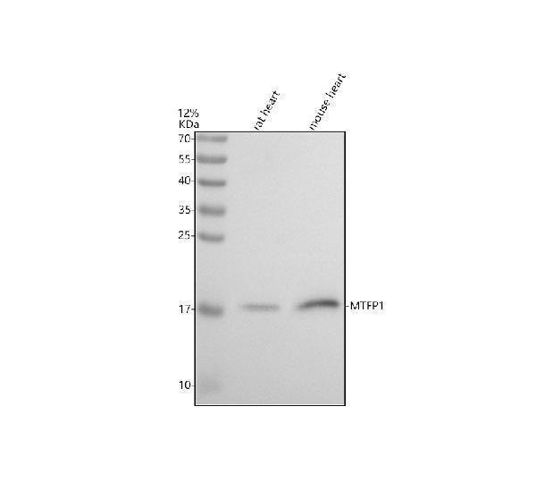 Western blot analysis of MTFP1 using anti-MTFP1 antibody (A10476)
