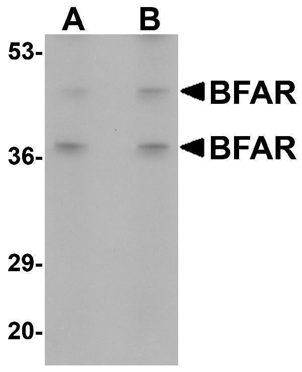 Western blot analysis of BFAR in human kidney tissue lysate with BFAR antibody at (A) 1 and (B) 2 μg/mL