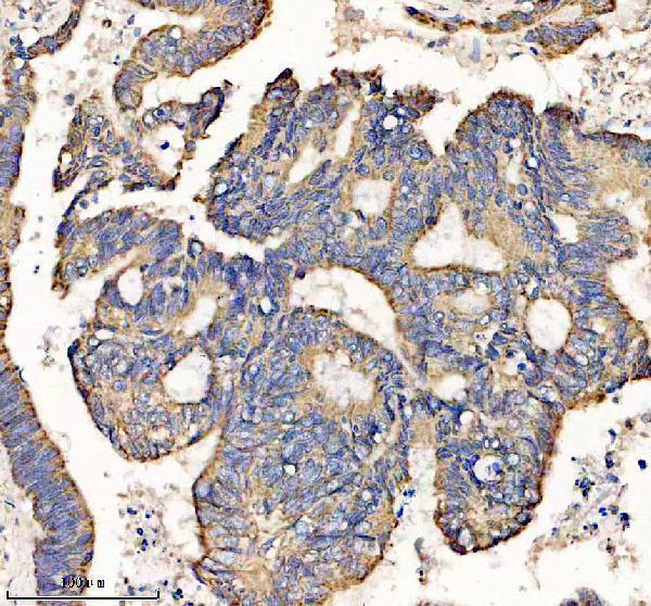 IHC analysis of UQCRQ using anti-UQCRQ antibody (A10480-1)