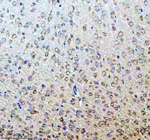 IHC analysis of UQCRQ using anti-UQCRQ antibody (A10480-1)