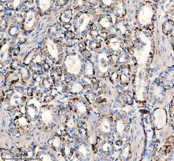 a10480 1 uqcrq primary antibodies ihc testing 3