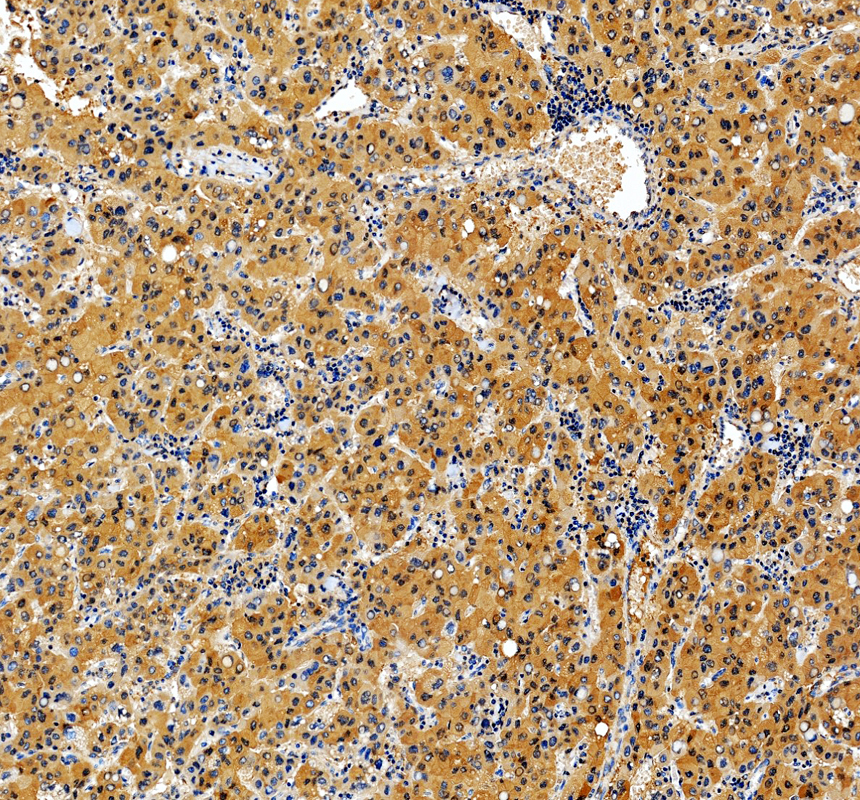 IHC analysis of HAAO using anti-HAAO antibody (A10482-1)