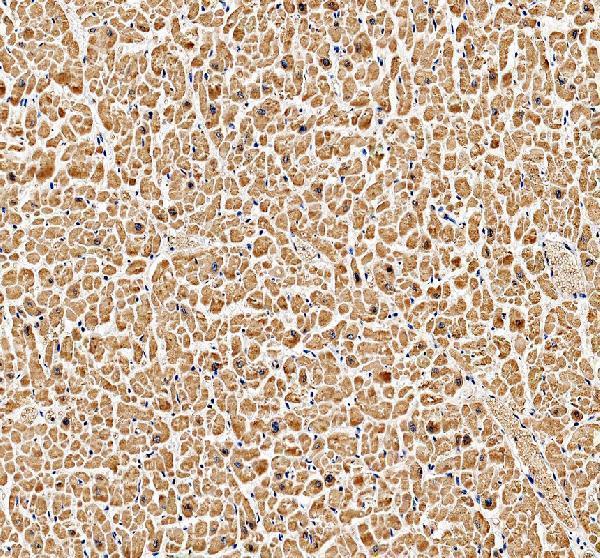 IHC analysis of MRPS16 using anti-MRPS16 antibody (A10488-2)