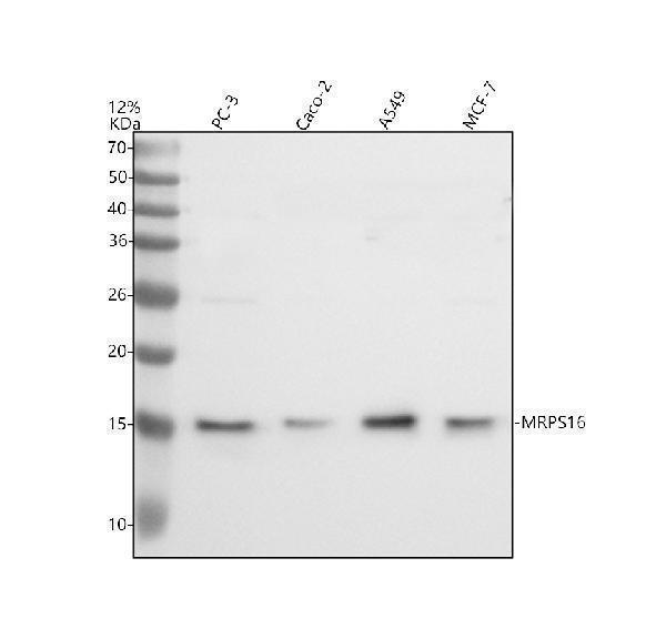 Western blot analysis of MRPS16 using anti-MRPS16 antibody (A10488-2)