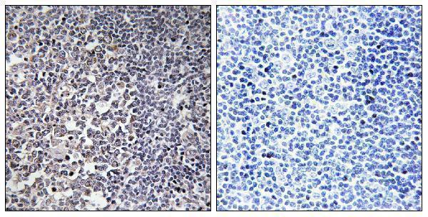Immunohistochemistry analysis of paraffin-embedded human tonsil tissue, using MRPS16 Antibody