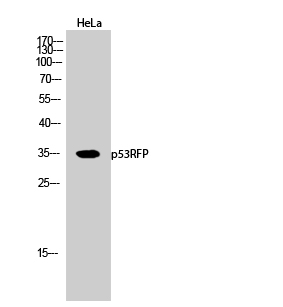 a10490 rnf144b primary antibodies wb testing 1