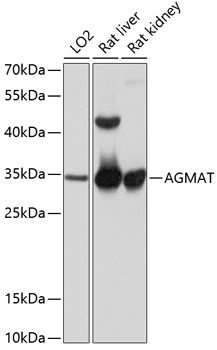 Western blot analysis of extracts of various cell lines, using AGMAT antibody  at 1:1000 dilution