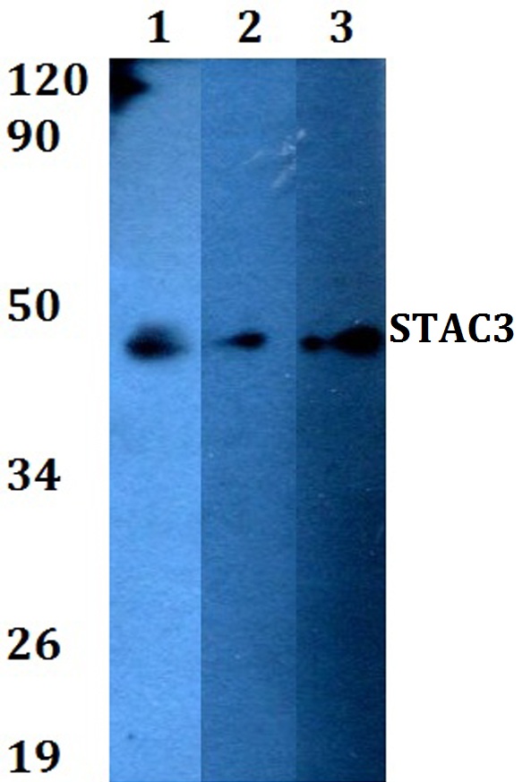 a10496 stac3 primary antiboties wb testing 1