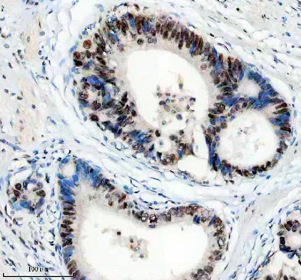 IHC analysis of PPIG using anti-PPIG antibody (A10500-1)