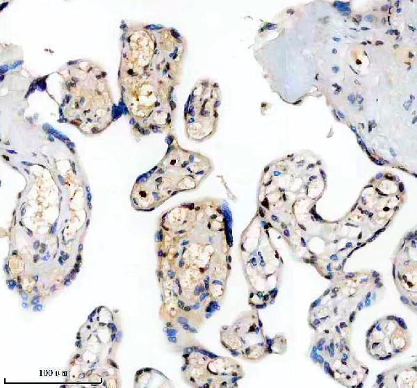 IHC analysis of PPIG using anti-PPIG antibody (A10500-1)
