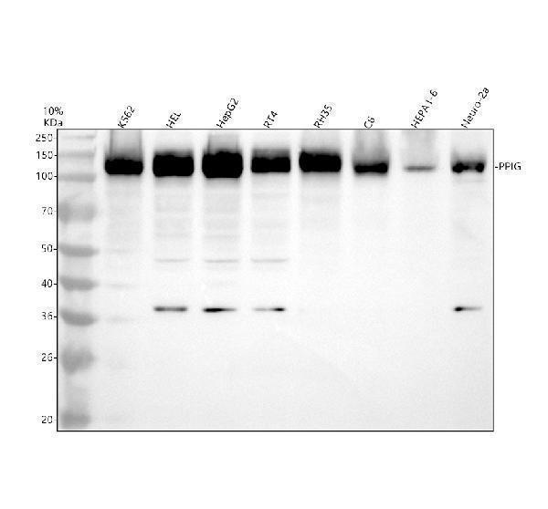 Western blot analysis of PPIG using anti-PPIG antibody (A10500-1)