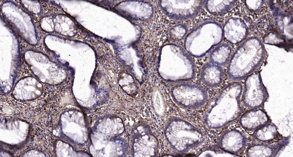 a10501 1 tmbim1 primary antibodies ihc testing 1