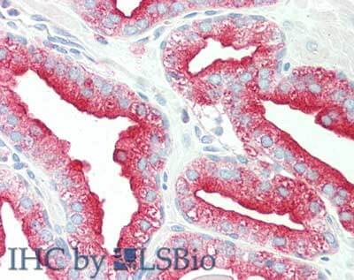 a10501 tmbim1 primary antibodies ihc testing 1