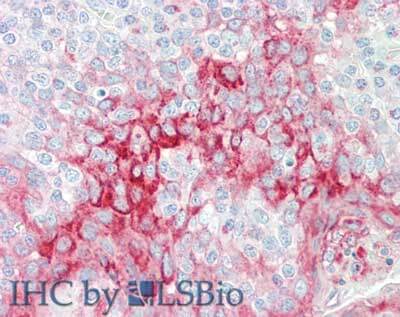 a10501 tmbim1 primary antibodies ihc testing 3