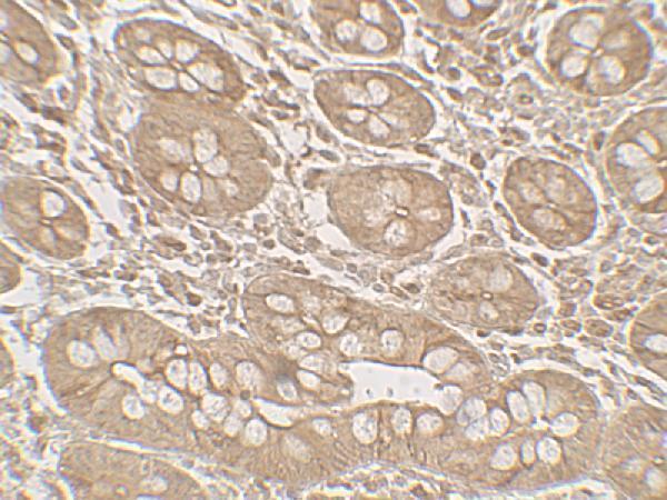 a10502 bhlha15 primary antibodies ihc testing 2