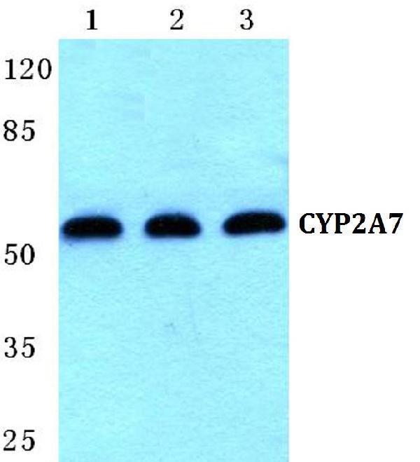 Western blot (WB) analysis of CYP2A7 polyclonal antibody at 1:500 dilution
Lane1:Hela cell lysate
Lane2:sp2/0 cell lysate
Lane3:PC12 cell lysate
