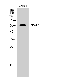 Western Blot analysis of 22RV1 cells using CYP2A7 Polyclonal Antibody diluted at 1:2000