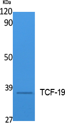 Western Blot analysis of extracts from Jurkat cells, using TCF-19 Polyclonal Antibody