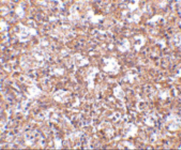 Immunohistochemistry of TEM4 in human spleen tissue with TEM4 antibody at 2