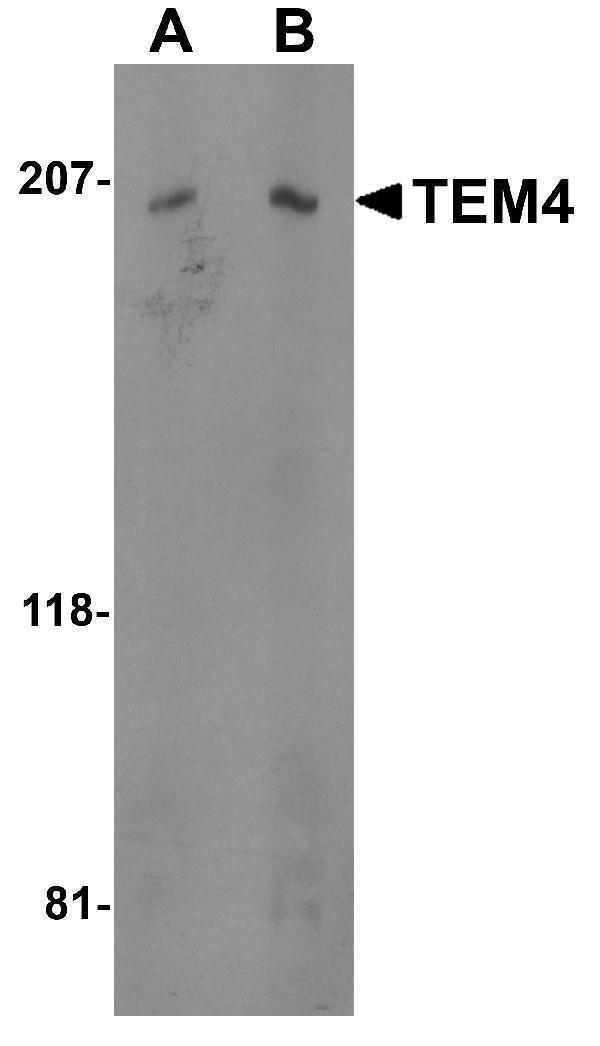 Western blot analysis of TEM4 in Jurkat cell lysate with TEM4 antibody at (A) 0