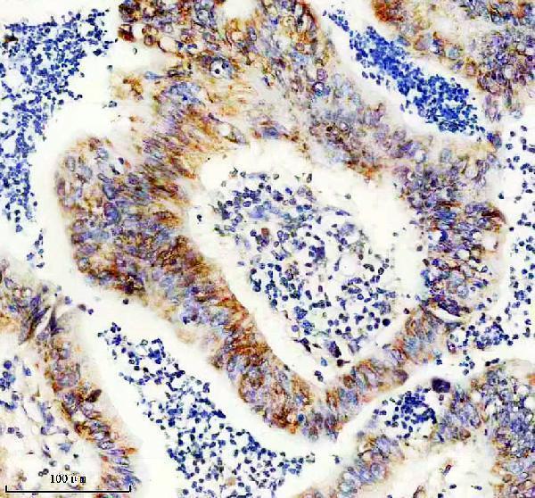 IHC analysis of DDOST using anti-DDOST antibody (A10511-1)