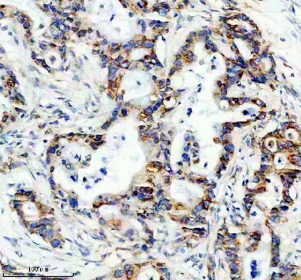 IHC analysis of DDOST using anti-DDOST antibody (A10511-1)