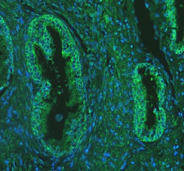 a10517 1 ndufa10 primary antibodies if testing 2
